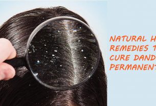 natural home remedy for dandruff