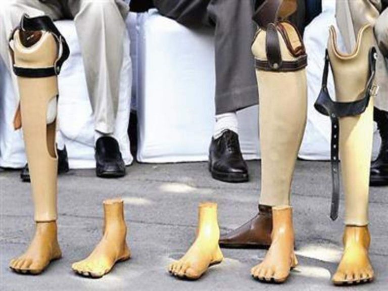 Know all about ‘JAIPUR FOOT’ an innovation beyond the limitations