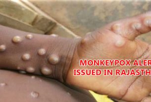 Monkeypox alert issued in Rajasthan
